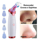 Removedor Instantâneo de Cravos e Espinhas